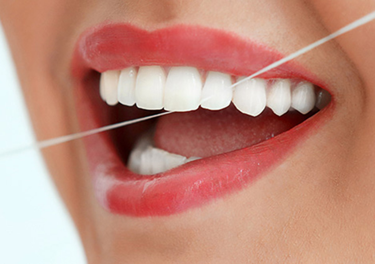 Can Teeth Fall Out After Getting a Deep Cleaning?